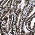 TRIM35 Antibody in Immunohistochemistry (Paraffin) (IHC (P))