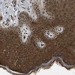 TRIM35 Antibody in Immunohistochemistry (Paraffin) (IHC (P))
