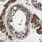 TRIM35 Antibody in Immunohistochemistry (Paraffin) (IHC (P))