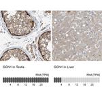 GCN1L1 Antibody in Immunohistochemistry (IHC)