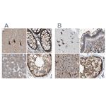 GCN1L1 Antibody in Immunohistochemistry (IHC)