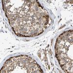 GCN1L1 Antibody in Immunohistochemistry (IHC)