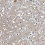 GCN1L1 Antibody in Immunohistochemistry (IHC)