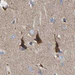 GCN1L1 Antibody in Immunohistochemistry (IHC)