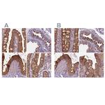 Annexin A13 Antibody in Immunohistochemistry (IHC)