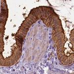 Annexin A13 Antibody in Immunohistochemistry (IHC)