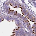 Annexin A13 Antibody in Immunohistochemistry (IHC)