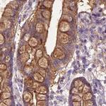 Annexin A13 Antibody in Immunohistochemistry (IHC)