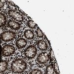 GABPB1 Polyclonal Antibody