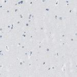 KRT76 Antibody in Immunohistochemistry (Paraffin) (IHC (P))