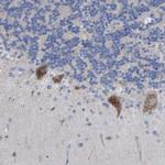 STRIP2 Antibody in Immunohistochemistry (Paraffin) (IHC (P))
