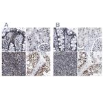 TPR Antibody in Immunohistochemistry (IHC)