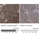 RABEP1 Polyclonal Antibody