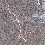 RABEP1 Antibody in Immunohistochemistry (IHC)
