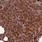 RNF128 Polyclonal Antibody