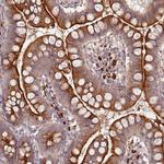 RNF128 Antibody in Immunohistochemistry (Paraffin) (IHC (P))