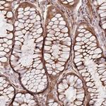 RNF128 Antibody in Immunohistochemistry (IHC)
