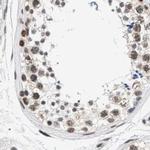 Nuclear Matrix Protein p84 Antibody in Immunohistochemistry (Paraffin) (IHC (P))