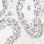 Nuclear Matrix Protein p84 Antibody in Immunohistochemistry (IHC)