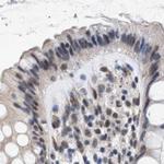 Nuclear Matrix Protein p84 Antibody in Immunohistochemistry (IHC)