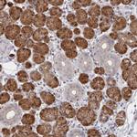 AGFG2 Antibody in Immunohistochemistry (IHC)