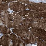 MURF3 Antibody in Immunohistochemistry (Paraffin) (IHC (P))