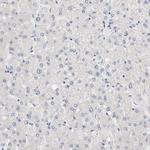 KRT76 Antibody in Immunohistochemistry (Paraffin) (IHC (P))