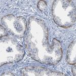 KRT76 Antibody in Immunohistochemistry (Paraffin) (IHC (P))