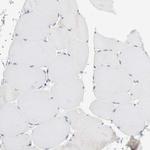 KRT76 Antibody in Immunohistochemistry (Paraffin) (IHC (P))