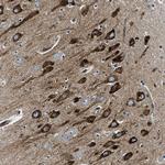 CDS2 Antibody in Immunohistochemistry (Paraffin) (IHC (P))