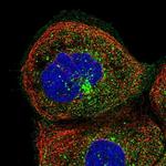 SMU1 Polyclonal Antibody