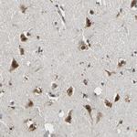 SMU1 Antibody in Immunohistochemistry (Paraffin) (IHC (P))