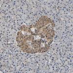 SMU1 Antibody in Immunohistochemistry (Paraffin) (IHC (P))