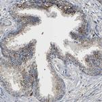 SMU1 Antibody in Immunohistochemistry (Paraffin) (IHC (P))