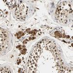 SMU1 Antibody in Immunohistochemistry (Paraffin) (IHC (P))