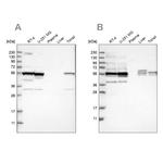 SMU1 Antibody in Western Blot (WB)