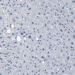 LANCL2 Antibody in Immunohistochemistry (Paraffin) (IHC (P))