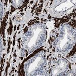 LANCL2 Antibody in Immunohistochemistry (Paraffin) (IHC (P))