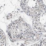 LANCL2 Antibody in Immunohistochemistry (Paraffin) (IHC (P))