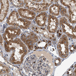 RAB31 Antibody in Immunohistochemistry (Paraffin) (IHC (P))