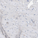 RAB31 Antibody in Immunohistochemistry (Paraffin) (IHC (P))