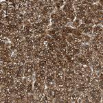 RAB31 Antibody in Immunohistochemistry (IHC)