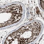 FAM221A Antibody in Immunohistochemistry (IHC)