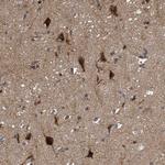 ITFG1 Antibody in Immunohistochemistry (Paraffin) (IHC (P))