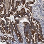 ITFG1 Antibody in Immunohistochemistry (Paraffin) (IHC (P))