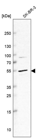 ITFG1 Antibody in Western Blot (WB)