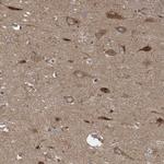 ITFG1 Antibody in Immunohistochemistry (IHC)