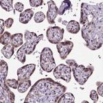 ORC5L Antibody in Immunohistochemistry (Paraffin) (IHC (P))