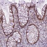 ORC5L Antibody in Immunohistochemistry (Paraffin) (IHC (P))