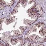 ORC5L Antibody in Immunohistochemistry (IHC)
